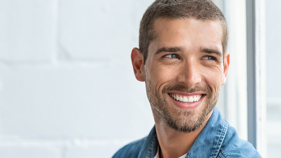 Man Smiling After Dental Veneers